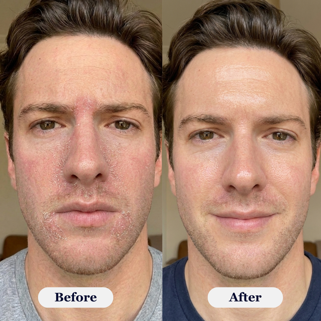 Rova Rejuvenating PDRN Cream