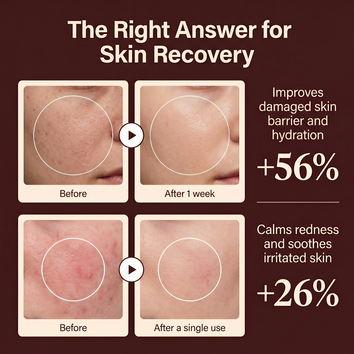 Rova Rejuvenating PDRN Cream W